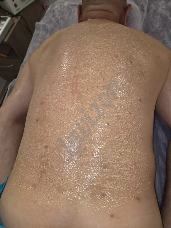 Классический массаж +медовый массаж